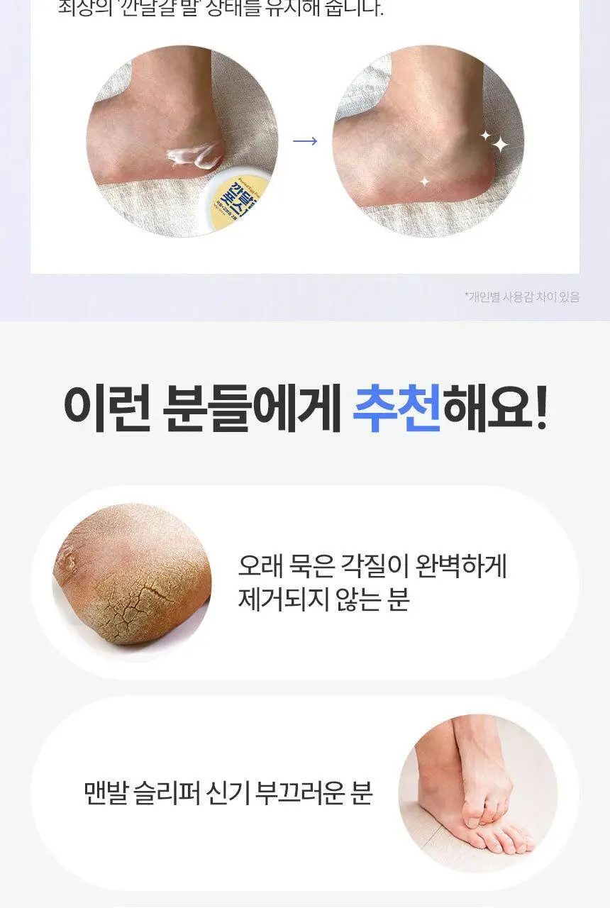 [NEW] 마스크킹 깐달걀 풋스파 필링 풋 마스크 1매 상세페이지 14